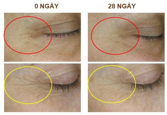 AH8 - Thành tựu đạt giải thưởng Nobel lần đầu tiên ứng dụng trong sản phẩm Việt ảnh 2