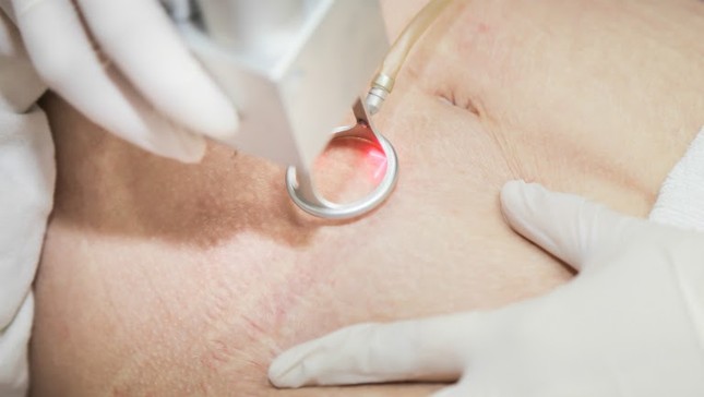 Phòng khám chuyên khoa thẩm mỹ JK độc quyền công nghệ trị rạn tái cấu trúc Healing Scar ảnh 1
