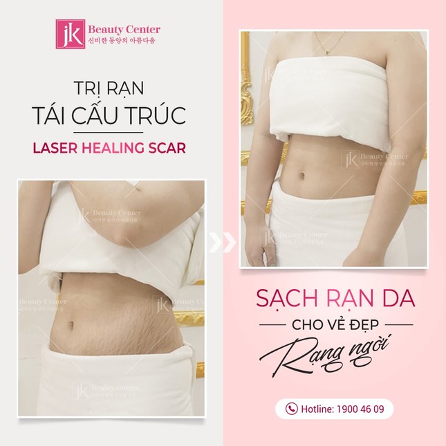Phòng khám chuyên khoa thẩm mỹ JK độc quyền công nghệ trị rạn tái cấu trúc Healing Scar ảnh 5