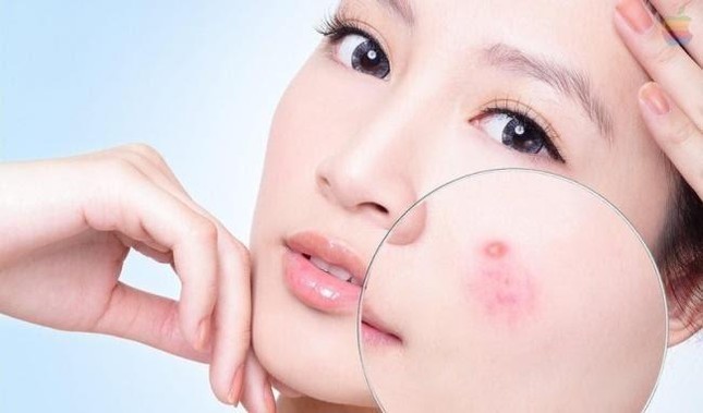 Serum tái tạo da Hoàng Thiên Sâm giải quyết mọi vấn đề của da mụn ảnh 1