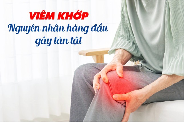 Viêm khớp - Nguyên nhân hàng đầu gây tàn tật ảnh 1