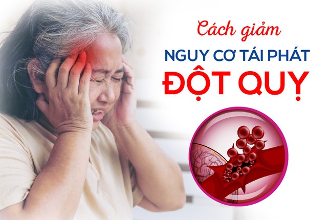 Giảm 16% nguy cơ đột quỵ tái phát nếu kiểm soát tốt yếu tố này ảnh 1