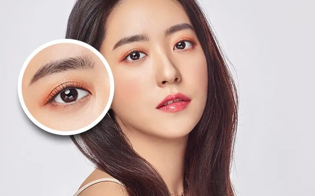 Cắt mí hay nhấn mí, đâu là lựa chọn tốt nhất? ảnh 2