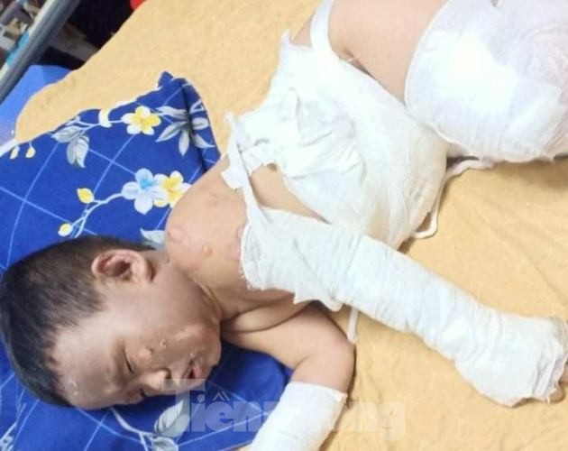Truy tìm kẻ cầm đầu vụ phóng hỏa giết người ở Bình Dương ảnh 1