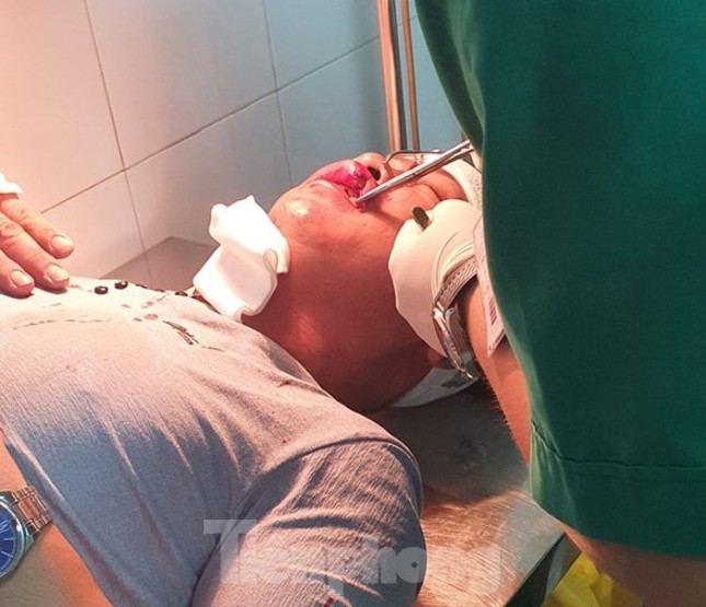 Nhiều người gặp nạn khi đi qua dự án đường 'nghìn tỷ' ảnh 5