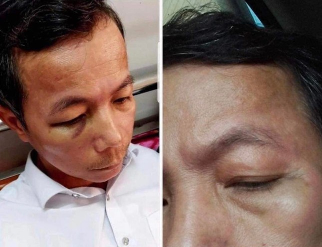 Vụ hiệu trưởng đánh hiệu phó nhập viện ở Quảng Bình: Cả hai cùng bị phạt tiền ảnh 1