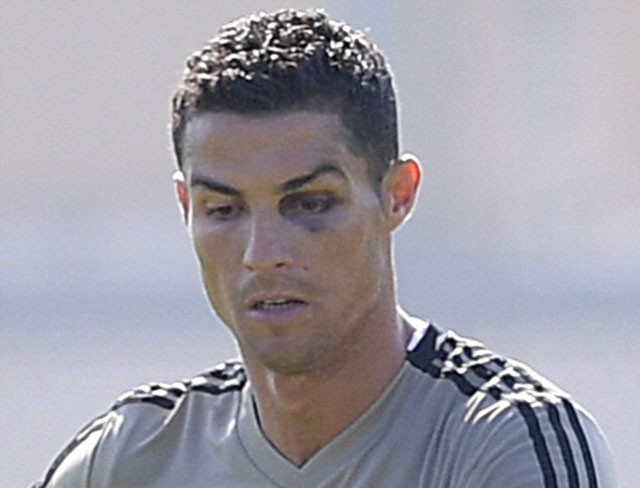 Vì Juventus, Ronaldo sẵn sàng ‘gạt bỏ’ chấn thương và ĐTQG ảnh 1