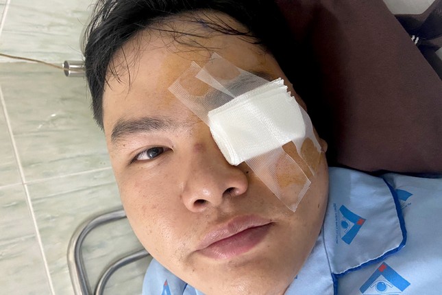 Xác minh vụ nam thanh niên tố bị gậy CSGT 'va' vào mắt ảnh 2
