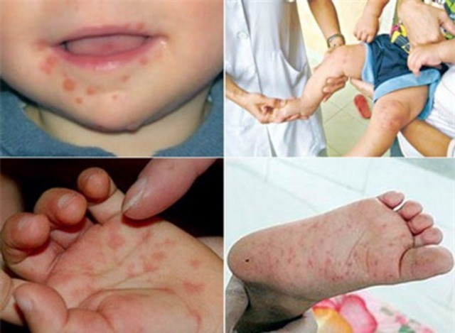 Những hiểm hoạ khôn lường với trẻ từ… nhà vệ sinh bẩn ảnh 1