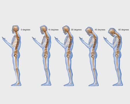 Nhắn tin gây hại nghiêm trọng đến cột sống ảnh 1