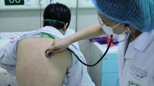 Cực hiếm: Việt Nam phát hiện người lớn bị ho gà ảnh 1