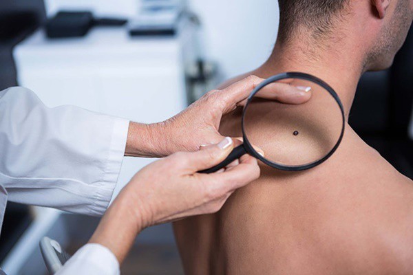 Nam giới đi khám ung thư ngay nếu có những dấu hiệu này ảnh 1