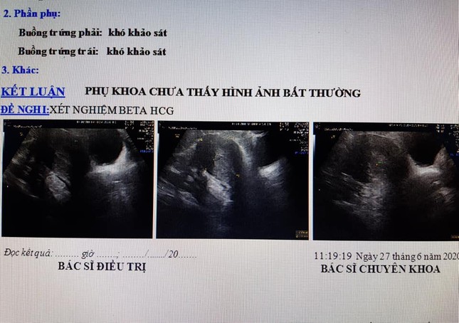 Uống thuốc thầy cúng chữa hiếm muộn, đến bệnh viện sinh con mới 'tá hỏa' không có thai ảnh 1