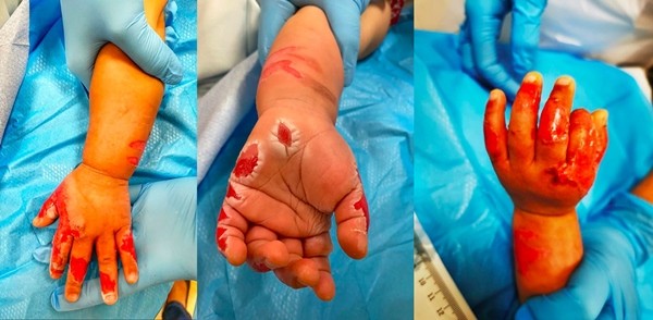 Kinh hoàng cảnh người giúp việc ấn tay em bé 14 tháng tuổi vào nước đang sôi ảnh 3