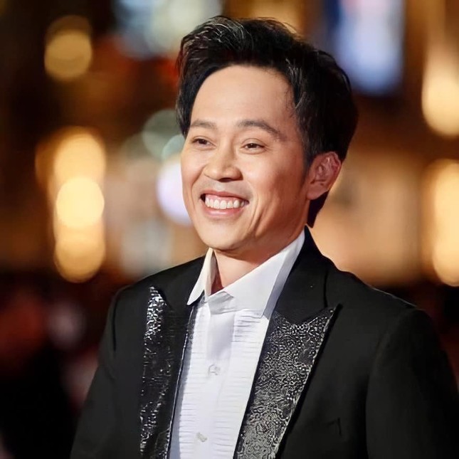 NSƯT Hoài Linh lần đầu nói về phẫu thuật thẩm mỹ: “Tôi cũng muốn làm da níu kéo tuổi xuân“ ảnh 3