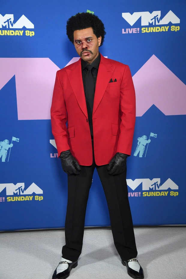 Dàn sao làm lố trên thảm đỏ VMAs 2020: Lady Gaga đội bể cá, The Weeknd bị đánh? ảnh 1