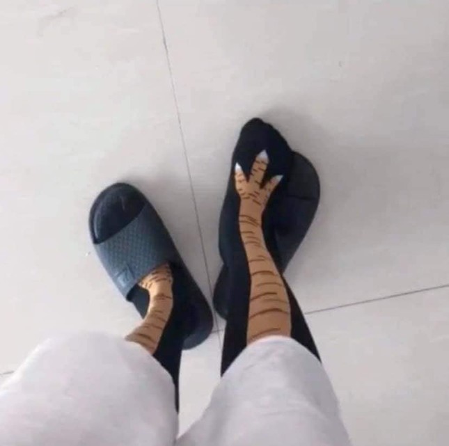 Cô gái chụp đôi chân “gầy đáng sợ” khiến dân tình xót xa, khi biết sự thật ai cũng cười bò ảnh 1