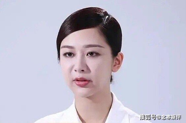 Cư dân mạng sốc với clip Dương Tử lộ gương mặt sưng, cứng đờ: Sự thật là? ảnh 3