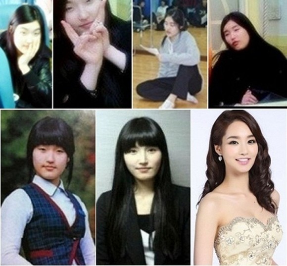 Sự thật gây sốc về bức ảnh của “Nữ hoàng dao kéo” Park Min Young trước khi thẩm mỹ ảnh 4