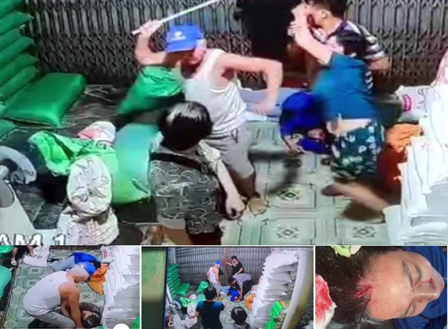 Con dâu nhập viện nghi bị bố chồng 81 tuổi đánh ảnh 1
