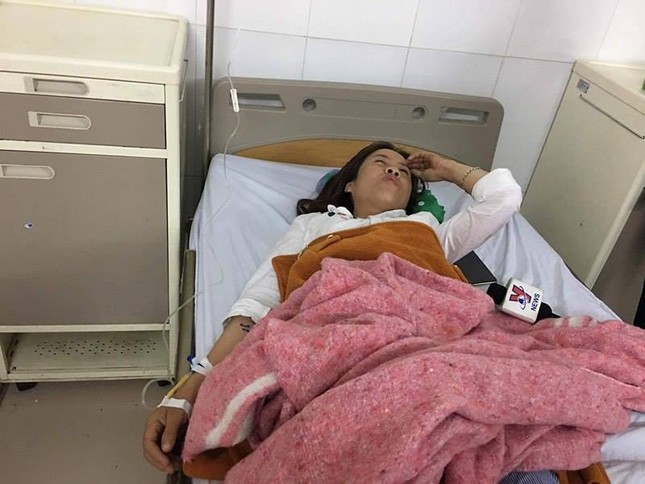 Nạn nhân vụ nổ xe khách: Người tôi đập lên đập xuống như điện giật ảnh 1