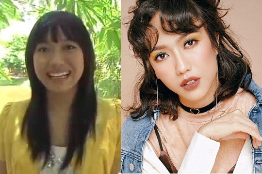 Loạt cây hài Việt vướng nghi án ‘dao kéo’ ảnh 4