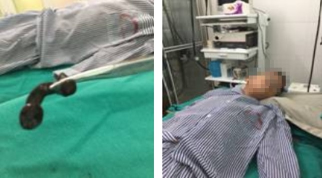Bản tin 8H: Kết luận bất ngờ vụ hơn 300 thi thể thai nhi lẫn trong rác ảnh 1
