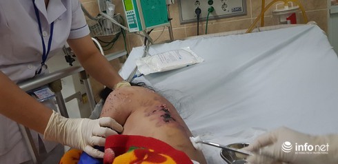 Nữ tiếp viên tố bị chủ ép bán dâm, đánh gãy xương, tra tấn như thời trung cổ ảnh 3