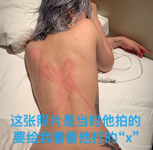 ‘Ngũ A Ca” Khuất Sở Tiêu bị tố bạo dâm, ép bạn gái cũ ký hợp đồng nô lệ ảnh 3