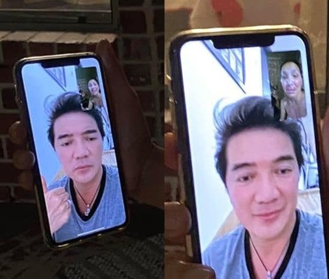 Hồng Ngọc lộ gương mặt biến dạng vì bỏng nặng khiến dân mạng xót xa ảnh 2