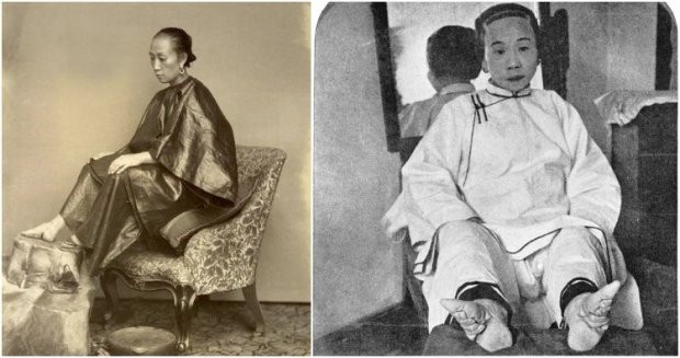 9 xu hướng làm đẹp "kinh dị" nhất trong lịch sử nhân loại ảnh 4