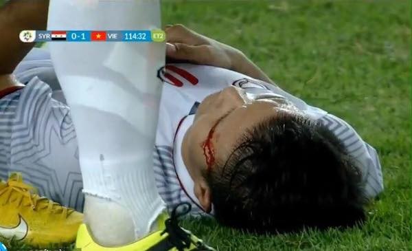 Cô bé khóc nức nở khi Quang Hải chảy máu, Duy Mạnh bị thương ở trận tứ kết ASIAD 2018 ảnh 1