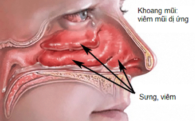 Thời điểm giao mùa và những "vị khách khó ưa" bất ngờ ghé thăm, phải làm sao? ảnh 3