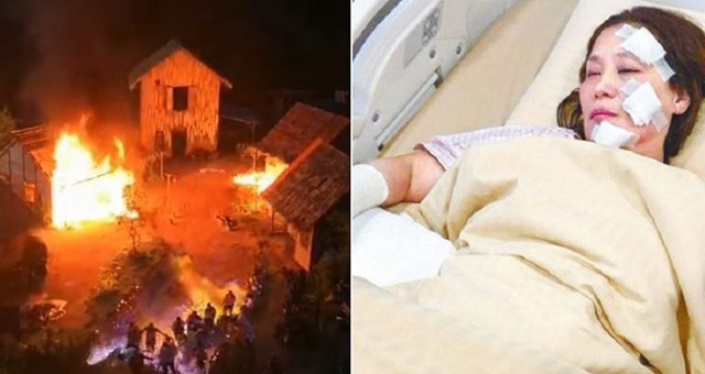 Malaysia: Hỏa hoạn lớn xảy ra trên phim trường khiến 31 diễn viên bị bỏng ảnh 3