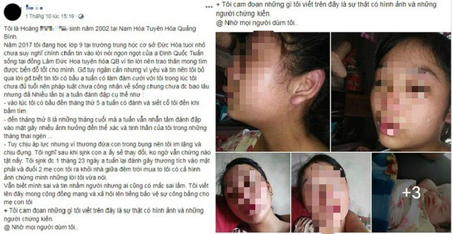 Mẹ trẻ 16 tuổi lên Facebook cầu cứu vì bị chồng bạo hành ảnh 1
