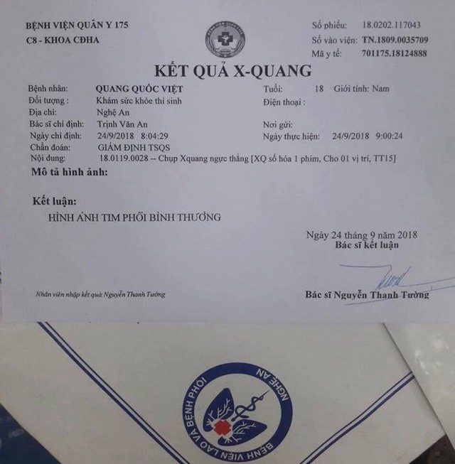 Mới nhập học, nam sinh viên Trường sĩ quan bị trả về địa phương vì ... bị bệnh lao phổi? ảnh 7