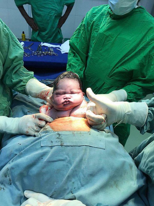 "Viral" nhất ngày: Khoảnh khắc em bé sơ sinh "hờn dỗi cả thế giới" ngay khi mới chào đời ảnh 1