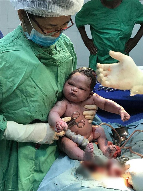 "Viral" nhất ngày: Khoảnh khắc em bé sơ sinh "hờn dỗi cả thế giới" ngay khi mới chào đời ảnh 2