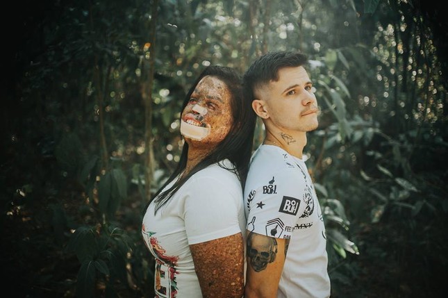 Chuyện tình cổ tích của cặp đôi Brazil khiến ai cũng tin rằng "tình yêu là không ranh giới" ảnh 1