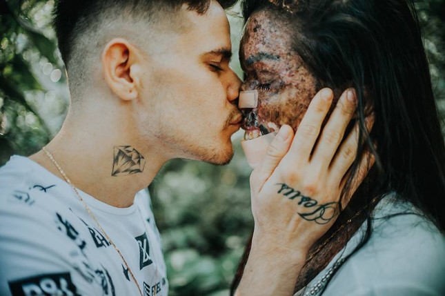 Chuyện tình cổ tích của cặp đôi Brazil khiến ai cũng tin rằng "tình yêu là không ranh giới" ảnh 2