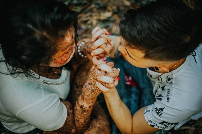 Chuyện tình cổ tích của cặp đôi Brazil khiến ai cũng tin rằng "tình yêu là không ranh giới" ảnh 6