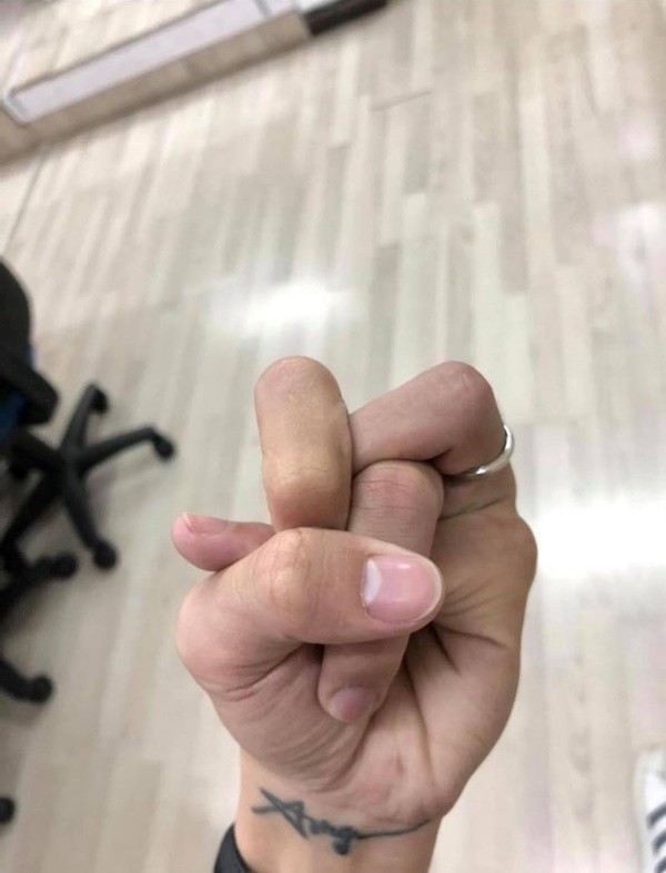 Cộng đồng mạng lại "xoắn não" với trào lưu mới: Thắt nút ngón tay ảnh 1
