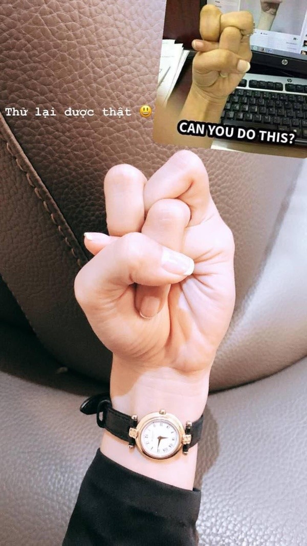 Cộng đồng mạng lại "xoắn não" với trào lưu mới: Thắt nút ngón tay ảnh 3