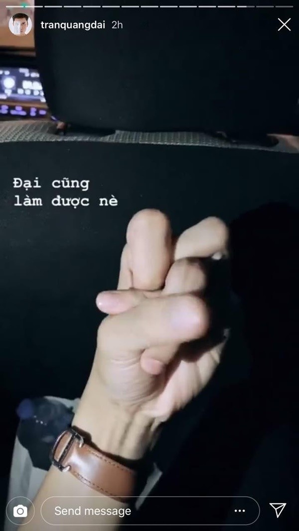 Cộng đồng mạng lại "xoắn não" với trào lưu mới: Thắt nút ngón tay ảnh 4