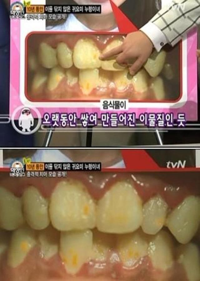 Cô gái xinh đẹp 10 năm không đánh răng nổi tiếng Hàn Quốc ảnh 2