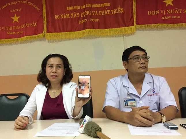 Thiếu nữ 19 tuổi hoại tử mũi vì tiêm chất làm đầy ảnh 1