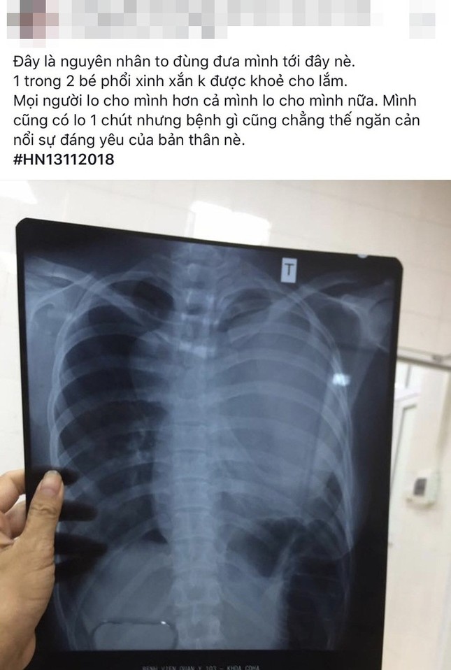 Tâm sự của cô gái 22 tuổi nghi bị ung thư phổi là lời nhắn khiến giới trẻ "lặng người" ảnh 8
