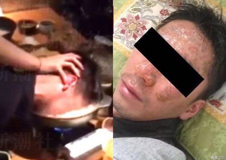 Nhật Bản: Ông chủ nhúng mặt nhân viên vào nồi lẩu để mua vui ảnh 1