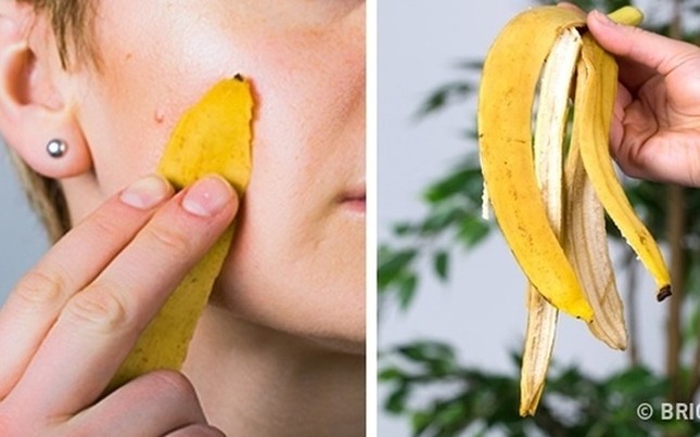 Khám phá công dụng làm đẹp không ngờ bằng vỏ chuối ảnh 3