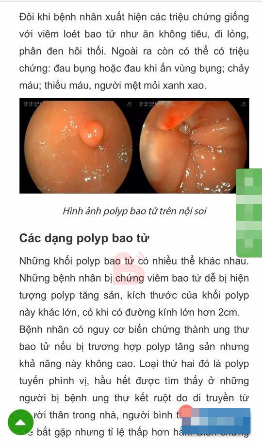 Tâm sự của cô gái có nguy cơ ung thư vì thói quen nhịn ăn khiến dân mạng giật mình ảnh 5
